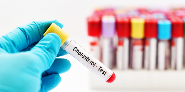 The Legacy of Statins: Advances in Treating High Cholesterol (alumni)